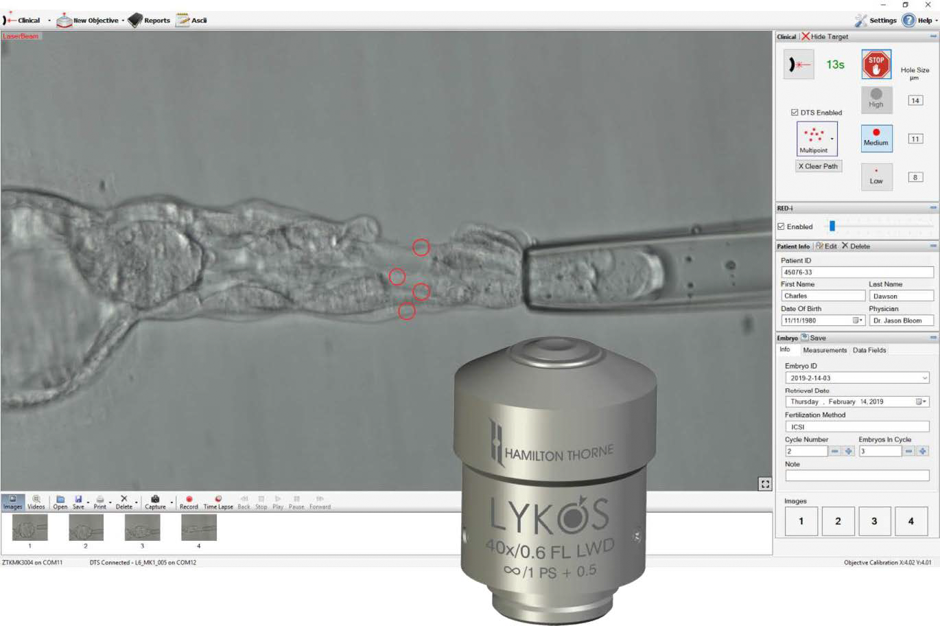 screenshot of software for LYKOS DTS Hamilton Thorne laser